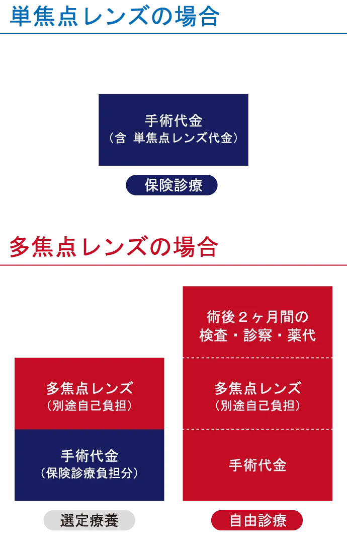 白内障手術のレンズ選択と費用の関係